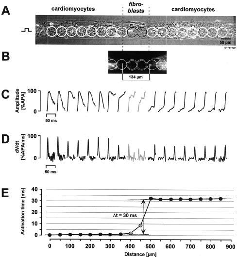 Experimental Studies of Conduction in Cell Culture Myocyte strand with fibroblast insert Optical mapping using