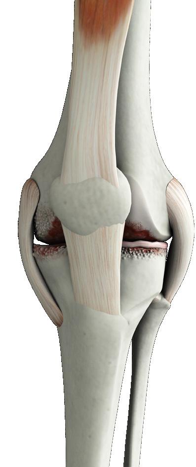 Arthritis and Knee Pain One of the most common causes of knee pain is arthritis.