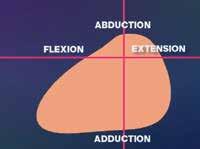 dislocation. The ROM difference is illustrated by the cone of motion.