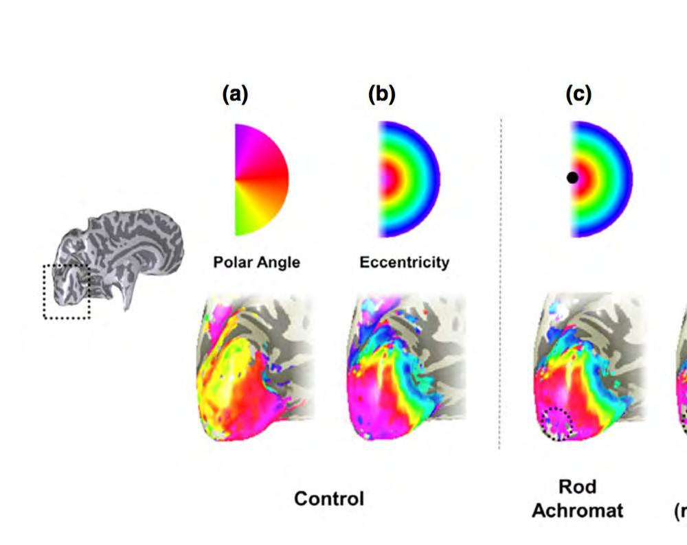 Review of fmri in
