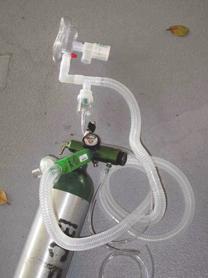 Noninvasive Ventilation (NIPPV) CPAP & BIPAP High pressure ventilatory pressure support through tight face mask CPAP: continuous positive pressure through both inspiration and