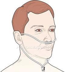 cannulae and masks Appropriate uses Spontaneously breathing patients Open