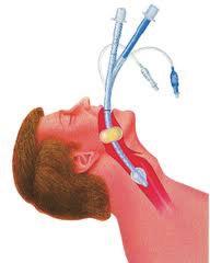 Supraglottic Airway / Extraglottic Airway aka Alternate Airway Characteristics: Blind insertion Goal is NOT to place in trachea (some can function in this position also) Skill acquisition and