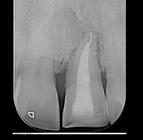 CLINICAL CASE Initial x-ray of