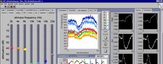 Method Custom-written software allowed nearsimultaneous measurement of: CAP thresholds and waveforms at seven different frequencies Boltzmann analysis of 200 Hz CM