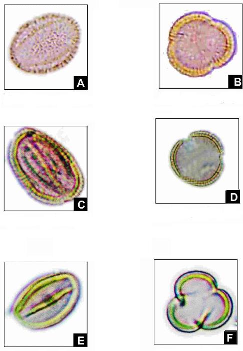 Fig. 2: Pollen microphotographs. Iberis amara E.V.
