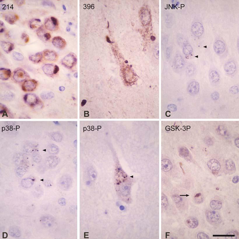 FTLD-tau P301L Intraneuronal inclusions are stained with phospho-specific anti-tau antibodies