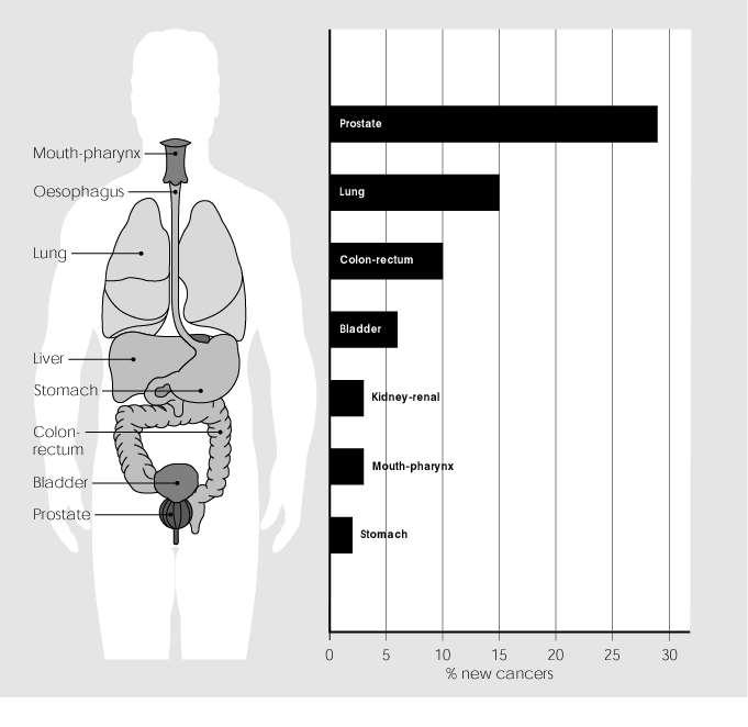 Incidence of cancer in males Prostate Lung Colorectal Bladder