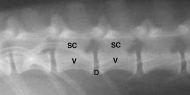 This is one of the areas on a radiograph we look for VSC, although many times VSC can be present and there are no radiographic changes.