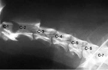 Sacral (pelvis) - 3 Below are radiographs (often referred to as X-rays) of the spine: C-1 and C-2 are referred to as the atlas and the axis.