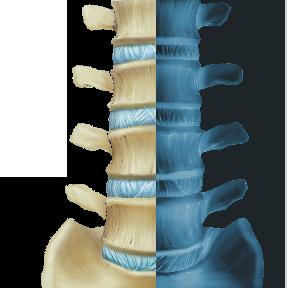 Radiographic Assessment for Back Pain North