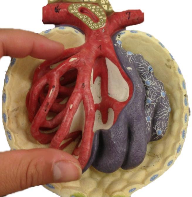 NOTE: on the model in image A, it has been cut through to show you the thickened cells. On some models it is not cut through, and just looks like a thickened area on the arteriole. See image B.