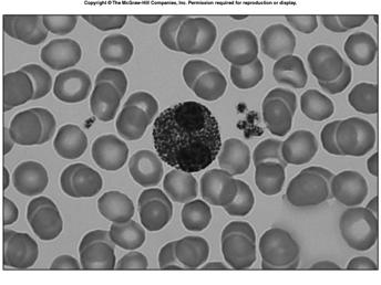 Eosinophils deep red granules in acid stain bilobed nucleus moderate allergic reactions defend