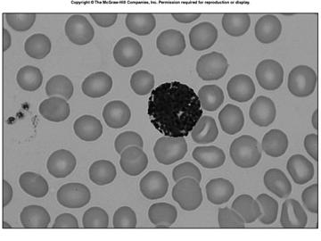 infestations and allergic reactions 13 Basophils deep blue granules in basic stain release