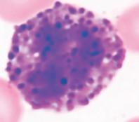 Eosinophil Stained by eosin and turns red Small % of WBC Contain a bilobed nucleus Contains substances that are important in the body s defense against tape work and hookworm Lessen the