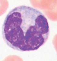 Basophil Stained by basic dye and turns blue Small % of WBC Ushaped or lobed nucleus Release histamine, a chemical that attracts other white blood cells to the site of infection and cause