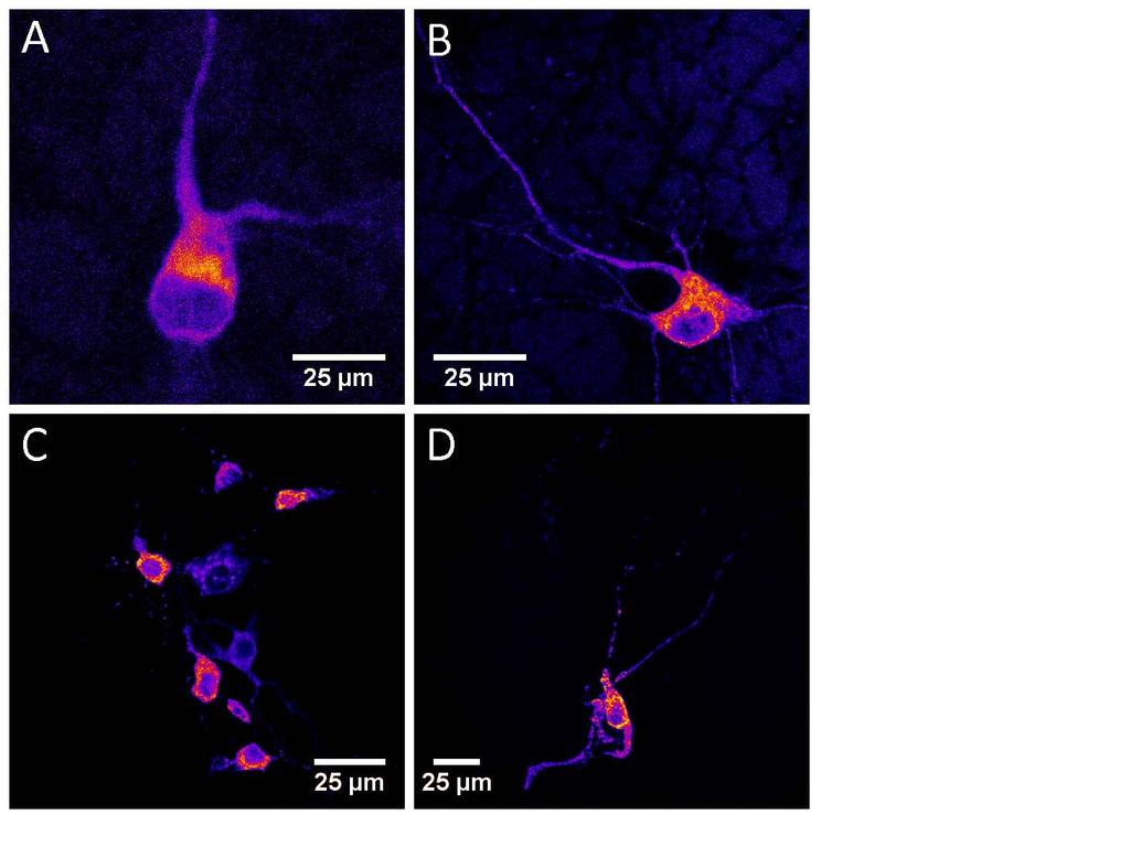 26 imaging conditions. It is also important to note the increased fluorescence intensity and the improved distribution of fluorescence of the cells in shown in figure 3.2B and 3.
