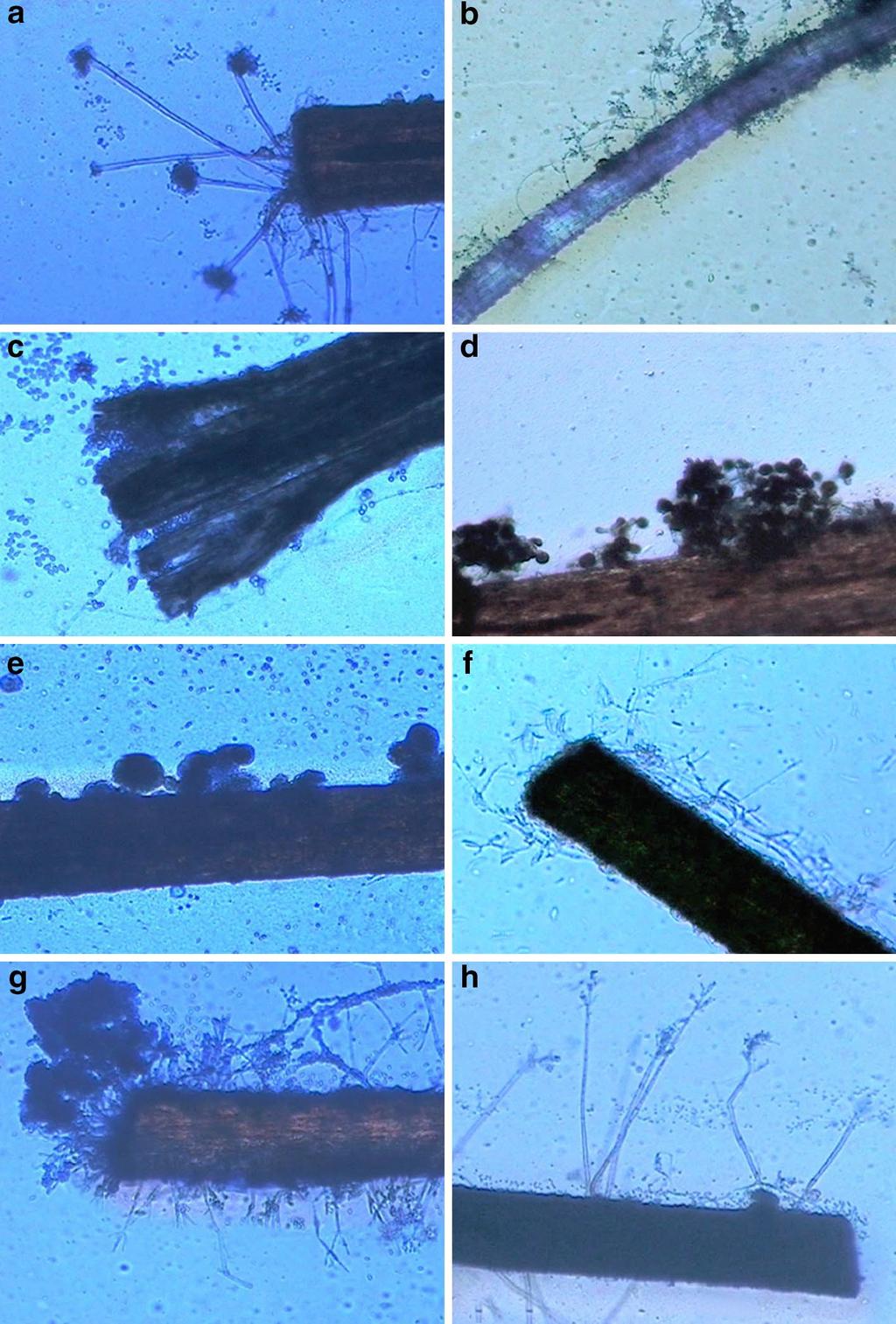 Page 5 of 6 Fig. 2 showing colonization of various keratinous baits by some keratinophilic fungal species. a Conidiophores of Aspergillus ustus arising from a hair shaft.