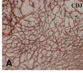 Murine Adipose-derived Regenerative Cells and Angiogenesis CD31+ Capillary-like network in vitro Compared to Fat Only
