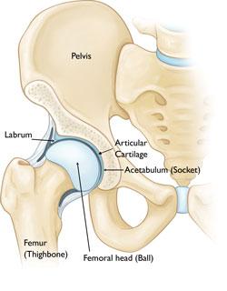 Adolescent Hip Dysplasia The hip is a "ball-and-socket" joint.
