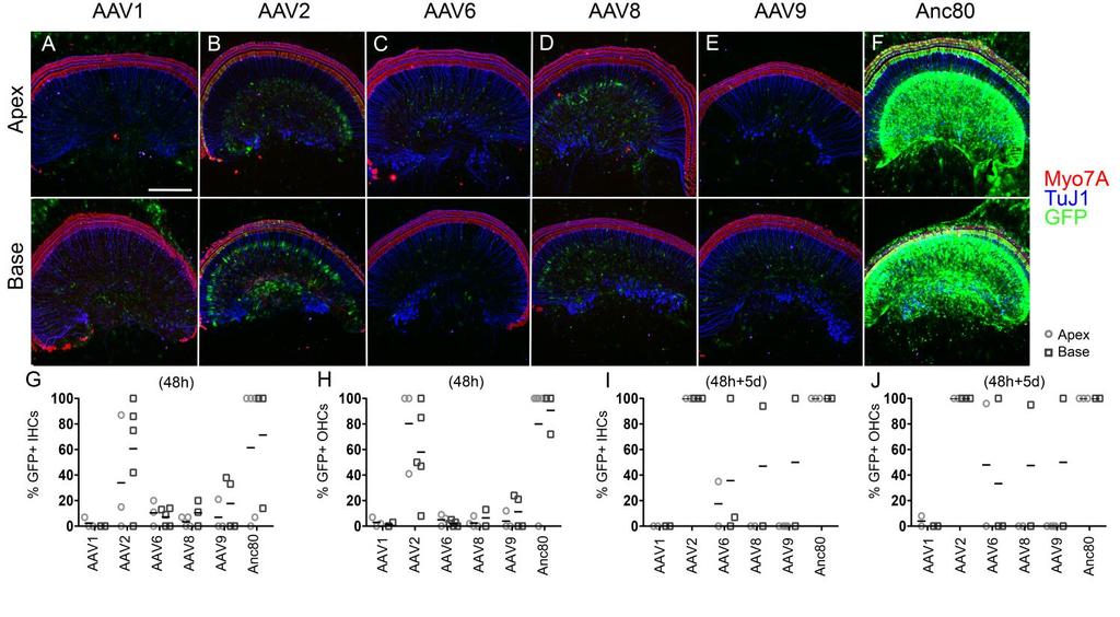 Supplementary Figure 1 Representative images of an in vitro comparison of several AAV serotypes regarding egfp expression in cochlear explants of CBA/CaJ mice.