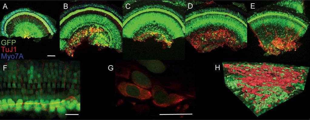 Supplementary Figure 5 Bilateral cochlear transduction from base to apex in mouse cochleas with Anc80.