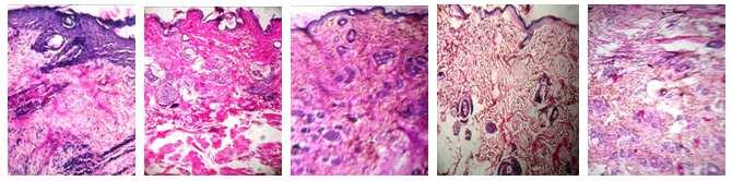 Fig-1 Effect of Aqueous fruit extract of Barringtonia acutangula in excision wound (% wound closure) In histopathological studies, a greater degree of epithelialization, collagen and fibroblastic