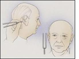 Air vs bone conduction Rinne test - presence of conductive hearing loss.
