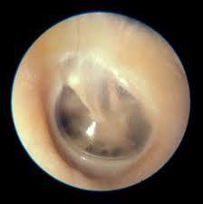 Outer ear Auricula (pinna) Flesh covered