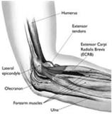 ELBOW- LATERAL EPICONDOLITIS 80 Depo-Medrol or 40 Kenalog 1-3 cc bupivicane BE CAREFUL OF SKIN ATROPHY Deeper is
