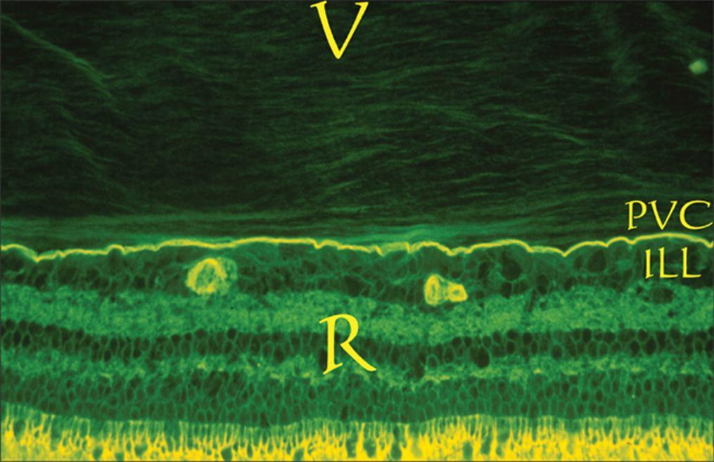Lamellar structure of the posterior vitreous cortex (PVC) in the