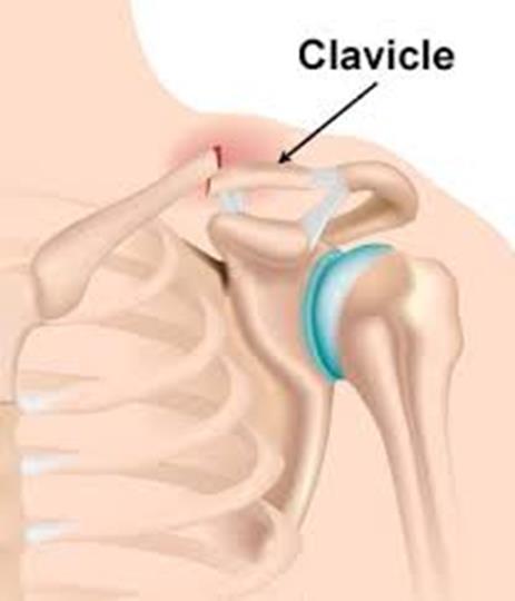 Structures to know: Sternoclavicular joint where the clavicle meets