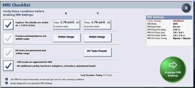 Figure 3. An example of the MRI Checklist screen for ICDs on the Merlin PCS 1.