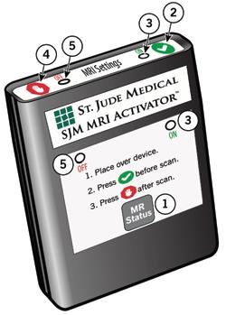 Figure 5. SJM MRI Activator handheld device 1. MR Status button 2. MRI Settings On button 3. Green LED 4. MRI Settings Off button 5.