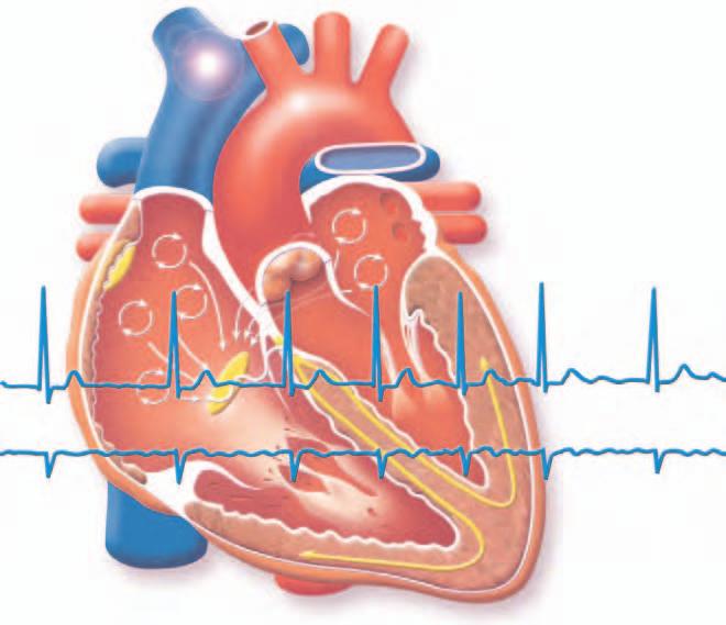 Fast Facts Fast Facts: Cardiac Arrhythmias