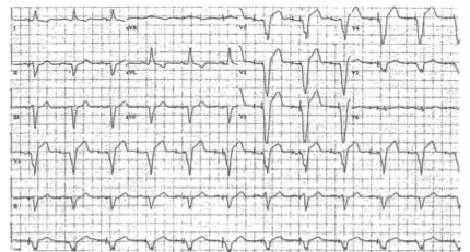 Don t Forget the Basics When you have a questionable ECG: IF you can,