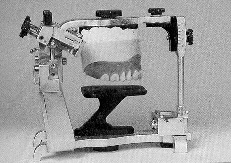 The denture with the cast is mounted on an