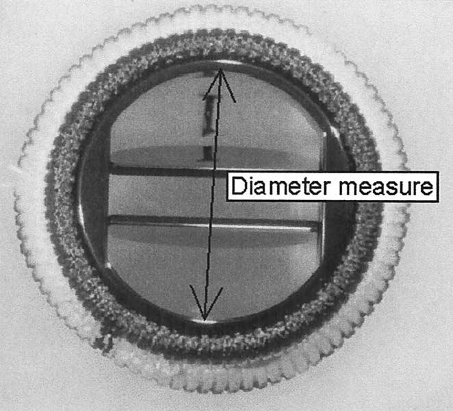 Chambers et al Surgery for Acquired Cardiovascular Disease Figure 1. Method of measuring internal diameter.