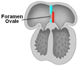 Lim and Everett, Congenital Heart Disease and Repair, 2 nd ed, 2004 The Foramen Ovale Formed as a communication when the septum primum only partially occludes the fenestration in the rightward septum