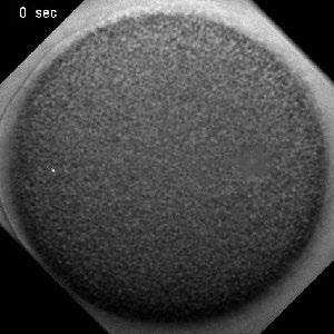 Video 1. Sperm MT aster centration in a normal spherical shape cell. Male pronucleus of fertilized sea urchin egg was visualized using DNA dye Hoechst.