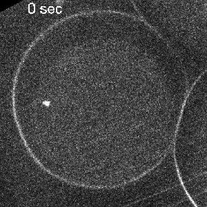 Frames were taken every second (shown every six frames) for 10 min. Video 5. Laser ablation of a centering MT aster 1: side ablation.