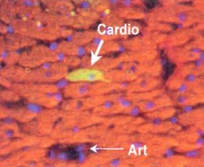 Cellular Cardiac Repair Doubts about Meaningful Transdifferentiation Murray, Nature 428: 664 04 Lin _ c-kit + X-gal or GFP cells injected into peri- infarct