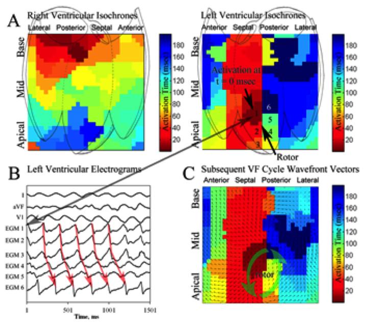 Ho, G and Krummen, DE, Surface ECG to Detect and Localize Human VF Rotors, Page 1 Computational Analysis of Surface Electrocardiography to Detect and Localize Human Ventricular Fibrillation Rotors