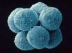 Stem cell harvest Bone marrow Adipose Umbilical blood Umbilical cord (Wharton s jelly) Amniotic membranes 2.