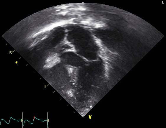 Echocardiography of