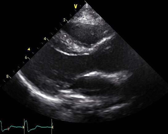Echocardiography of of