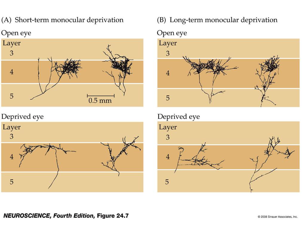 23. Effect of monocular deprivation on