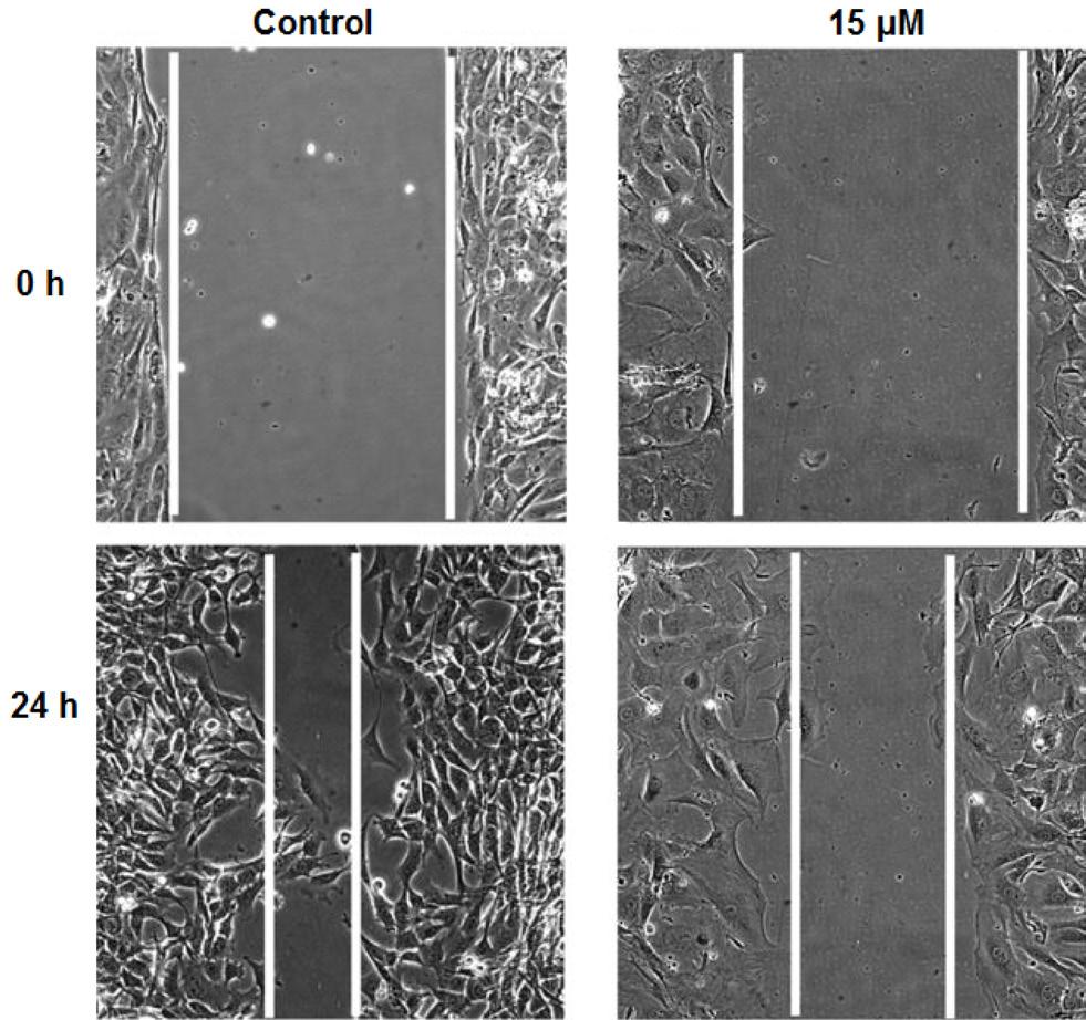 To further confirm the apoptosis at molecular level, we determined the expression of Bax and Bcl-2 proteins.