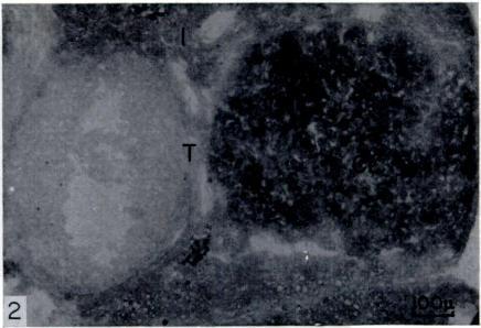 Yellow and orange filters were used for photography so as to increase contrast between formazan and the counterstain.