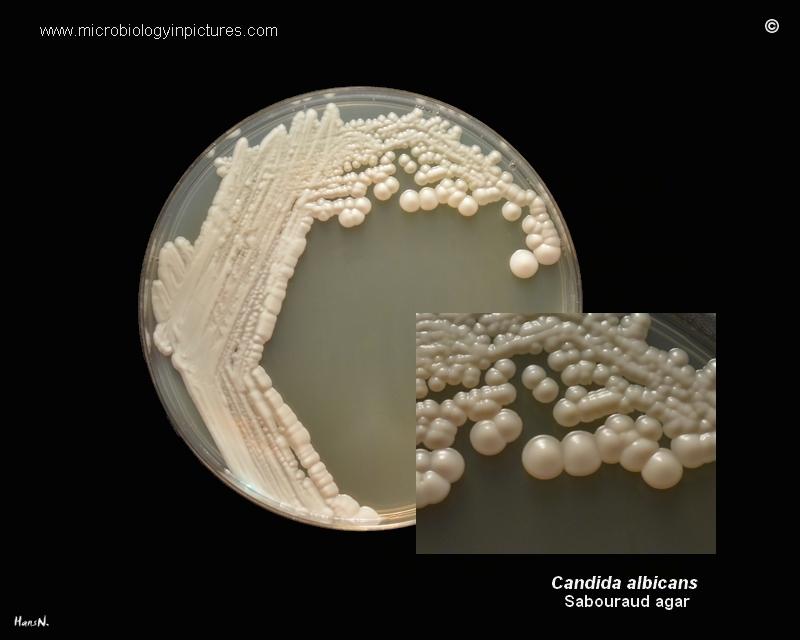 Cultural Characteristics of Candida albicans SDA - Creamy,